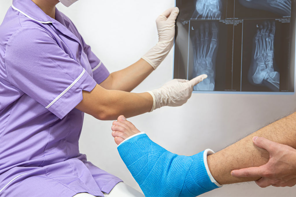 Tratamiento de Fracturas